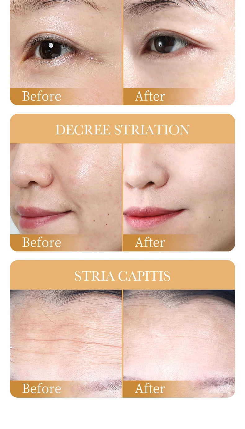 Collagen Facial Mask (10pcs) – Anti-Wrinkle, Moisturizing & Brightening